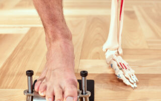 Plantar Fasciitis